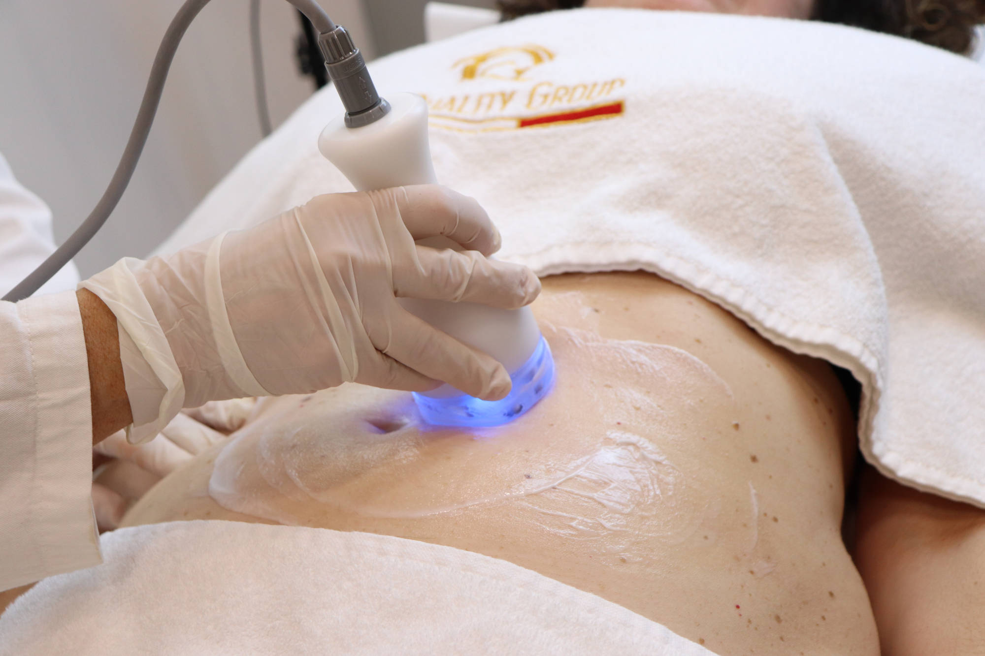 La Radiofrequenza: La nuova frontiera della bellezza